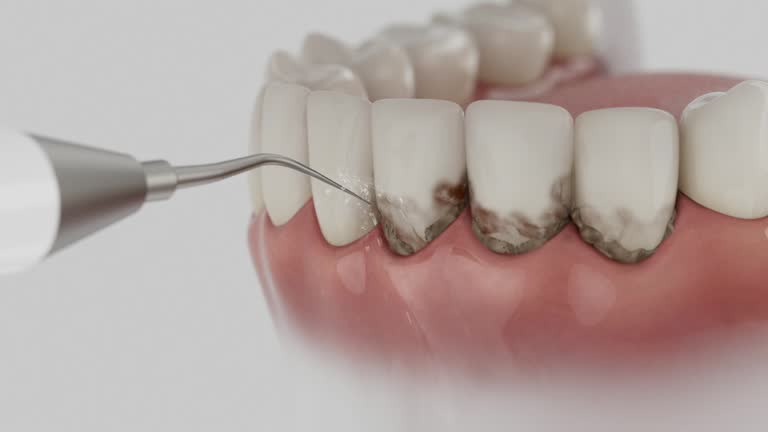 Trusted Dental Crowns And Bridges service in Chatmoss, VA - Dentist Open Now